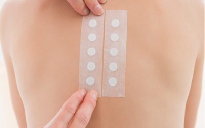 Alergia a conservantes de cosméticos: Metilisotiazolinona