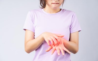 ¿Puede un medicamento provocar una reacción al sol?